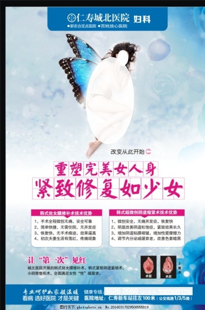 处女膜广告 私密整形,妇科杂志 医疗咋子 阴道紧缩-